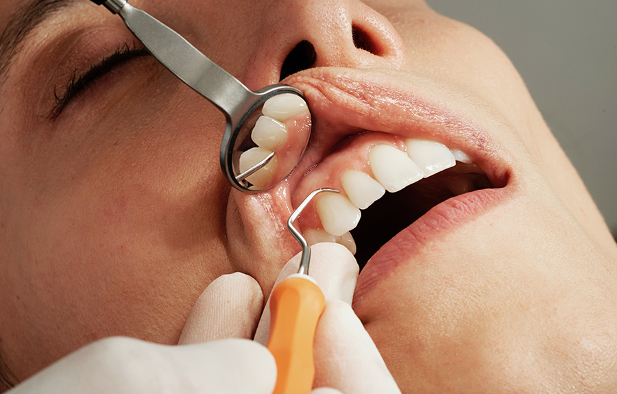 Zahntherapie | Zahnarztpraxis in Zscherben, Teutschenthal